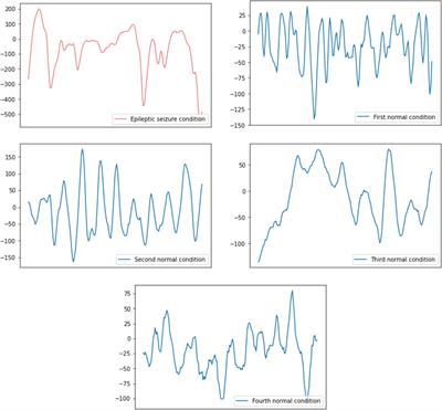 A One-Dimensional CNN-LSTM Model for Epileptic Seizure Recognition Using EEG Signal Analysis